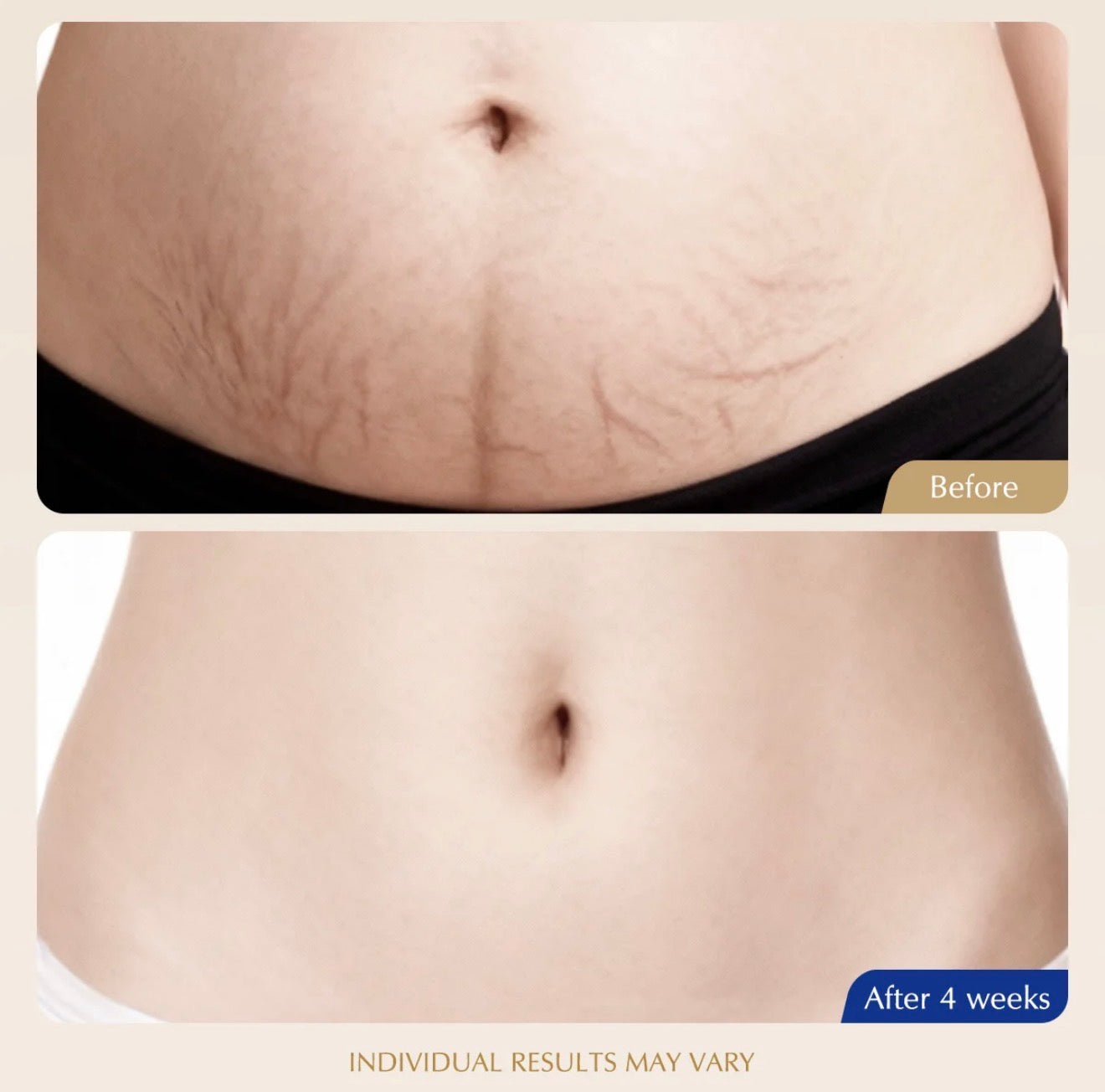 GoldTherm Sculpting Firming Cream